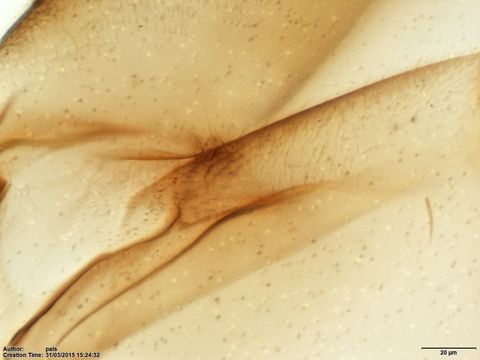 Warileya_rotundipennis-BMNH(E)1721982_PT-female_setae_katepisternum-40x.tiff