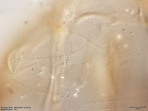 Lutzomyia_xerophila-BMNH(E)1722105_PT-female_ventro_cervical_sensillae-40x.tiff